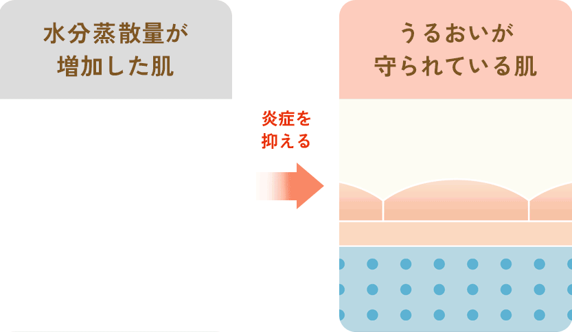 保湿力(バリア機能)を守る