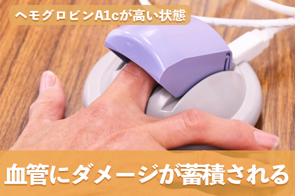 ヘモグロビンA1cが高い状態が続くと血管にダメージが蓄積される